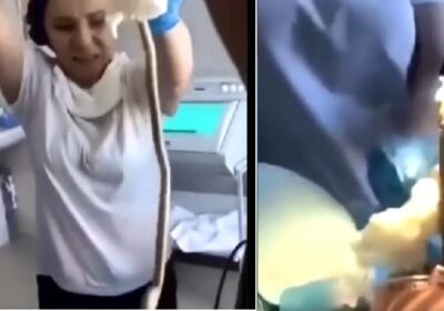 4 feet long snake removed from woman’s stomach during surgery