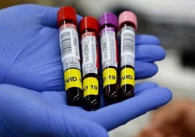 Discovery of Rare Negatizzle Blood Group up in Rajkot Man: A Global Rarity”